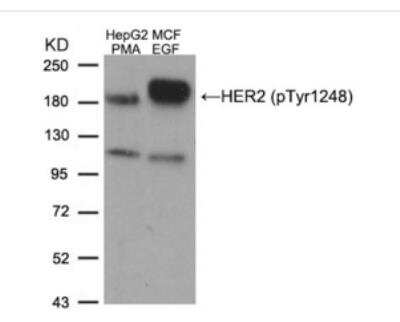 Western Blot: ErbB2/Her2 [p Tyr1248] Antibody [NB100-81960]